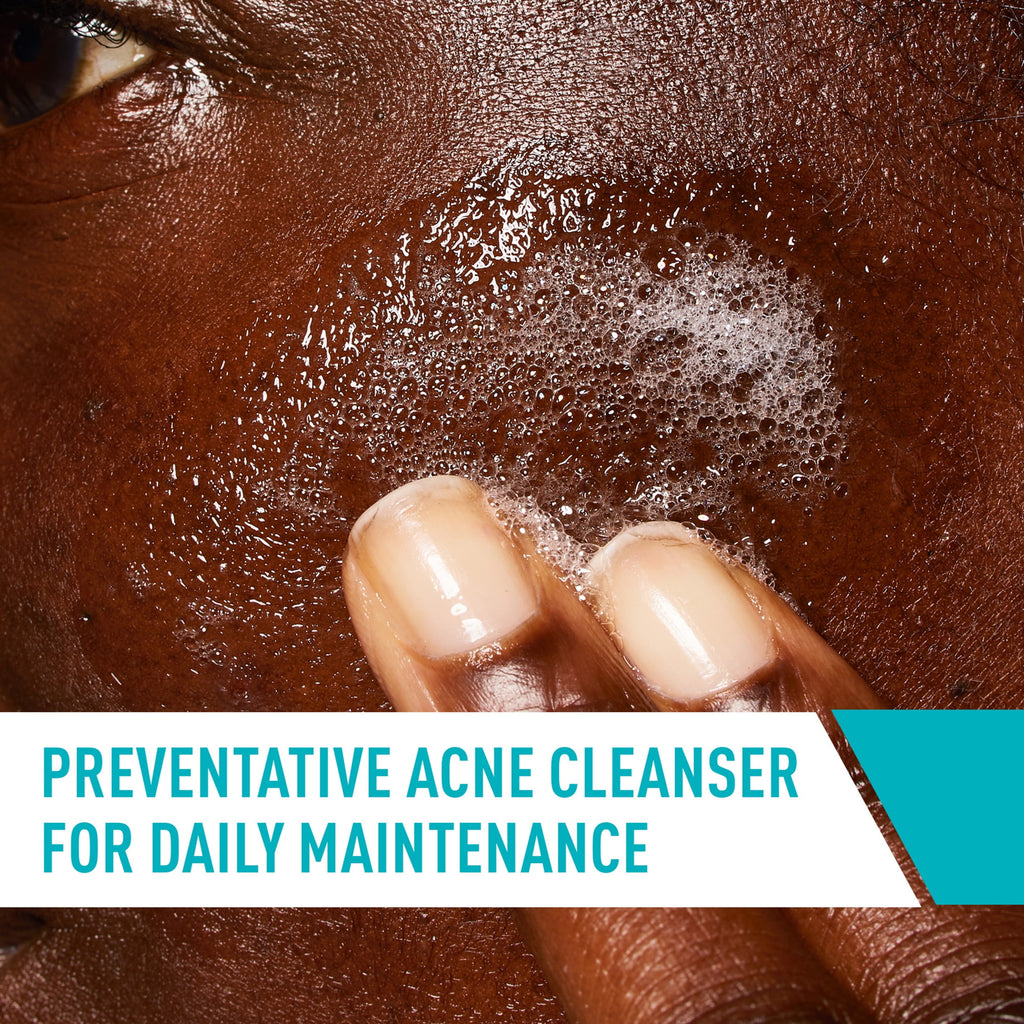 CeraVe Skin Care Acne Control Face Cleanser with 2% Salicylic Acid Clears Acne Blackheads Pores