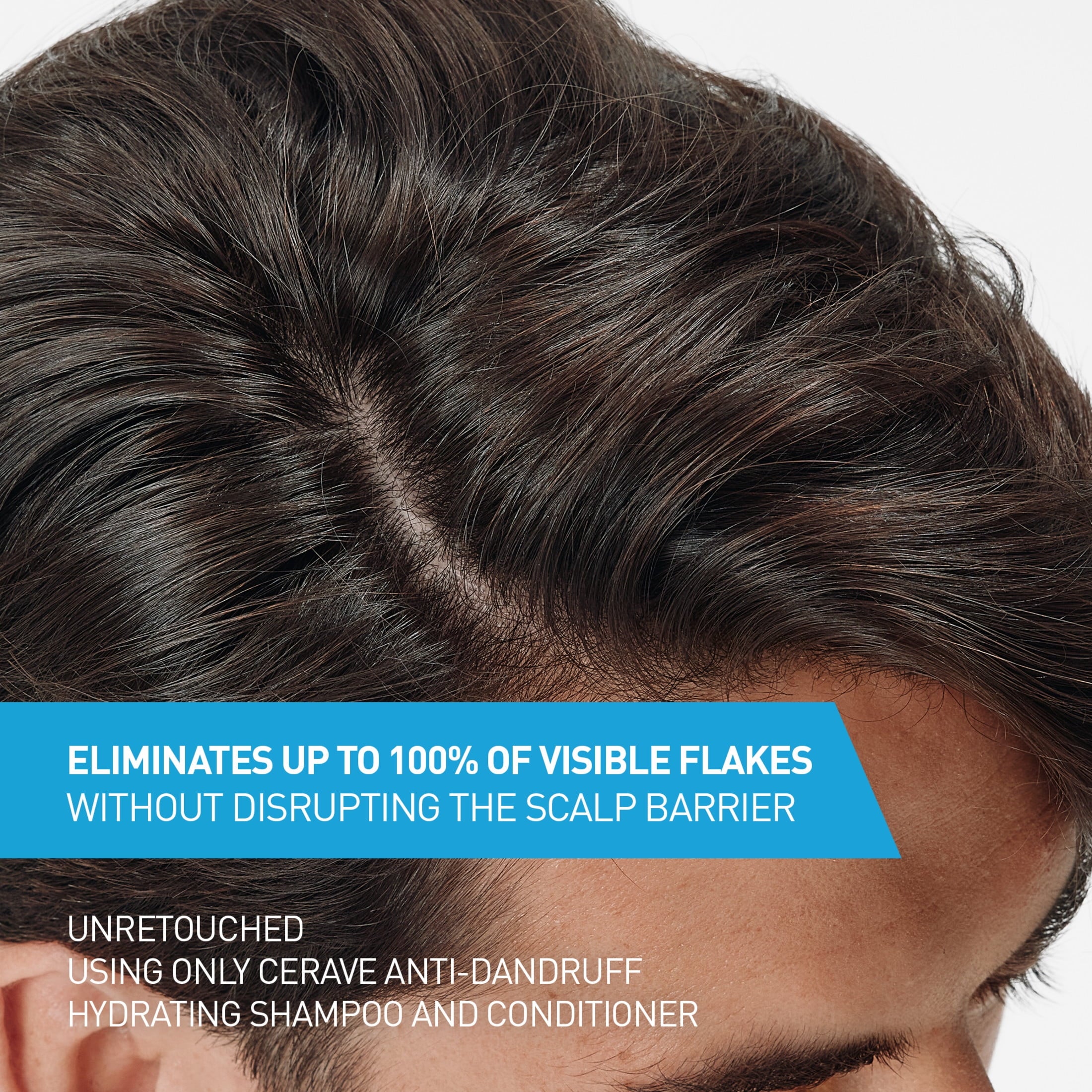 CeraVe Hydrating Anti-Dandruff Conditioner for Flakey Itchy Scalp 9 fl oz