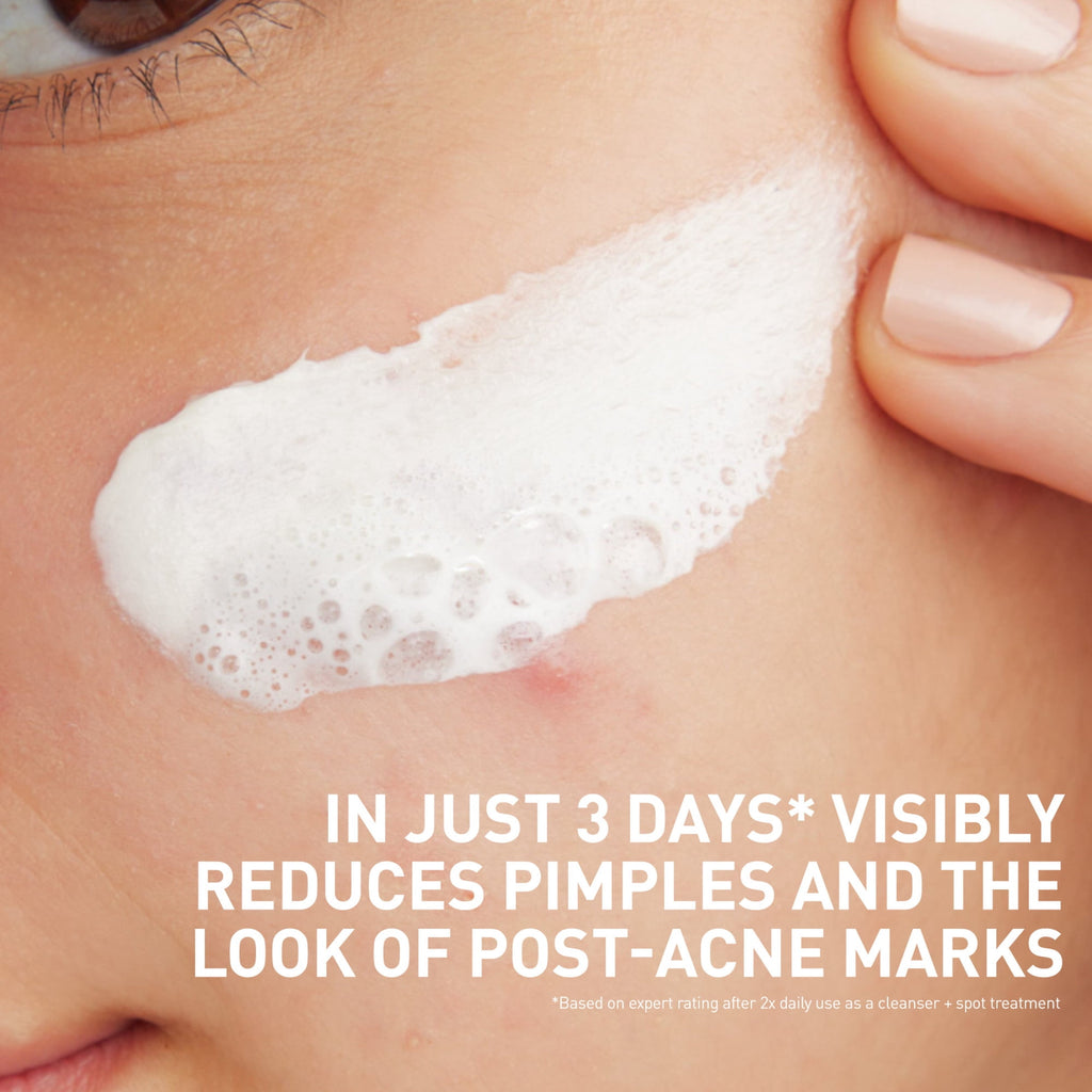 (2 pack) CeraVe Clay to Foam Acne Facial Cleanser, Mask & Spot Treatment for Acne Prone Skin 4 oz