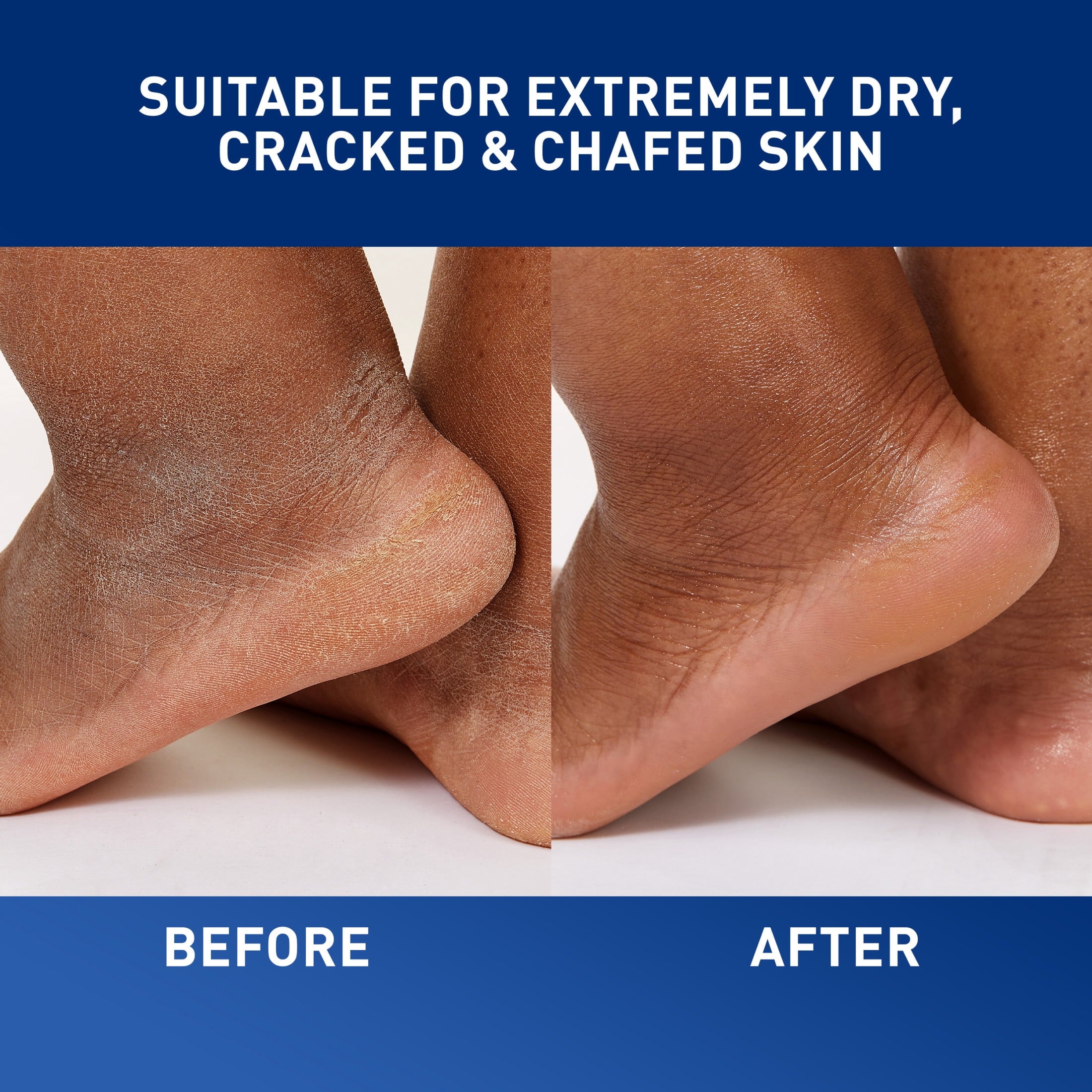 CeraVe Dry Skin Moisturizer Healing Ointment with Petrolatum Hyaluronic Acid Ceramides Fragrance Free 5 oz
